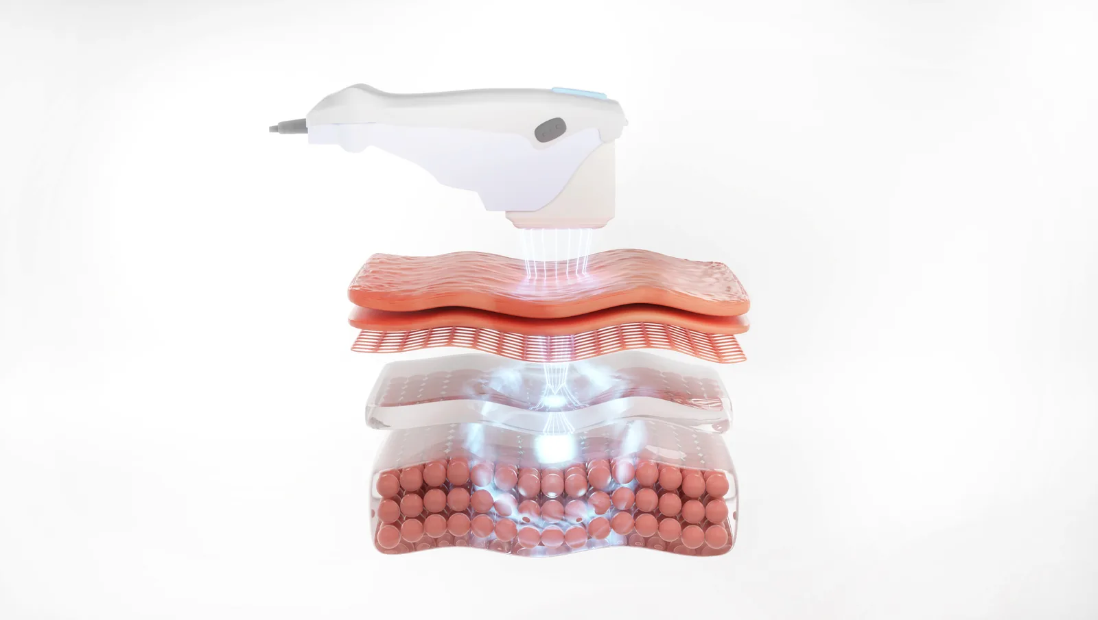 Illustration du fabricant : pièce à main émettant des ultrasons focalisés vers les couches de la peau